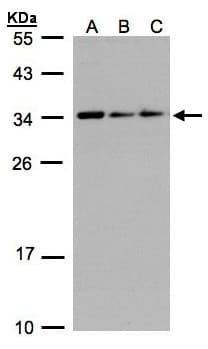 IHC-plus™ Polyclonal Rabbit anti-Human SARNP / Hcc-1 / CIP29 Antibody (aa4-210, IHC, IF, WB)