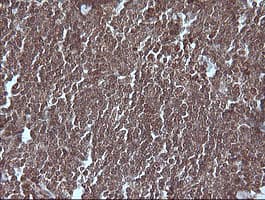 MAP2K1 / MKK1 / MEK1 Antibody (clone OTI2A9)