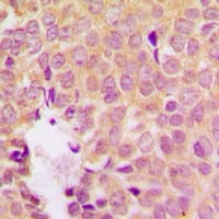 MAP2K1 / MKK1 / MEK1 Antibody (phospho-Ser298)