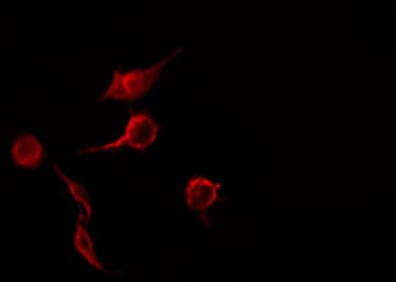 Polyclonal Rabbit anti-Human TNFRSF1B / TNFR2 Antibody (IHC, IF, WB)