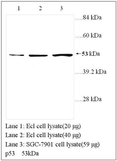 TP53 / p53 Antibody