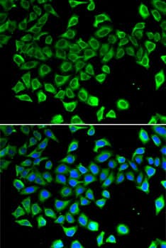 LCN2 / Lipocalin 2 / NGAL Antibody