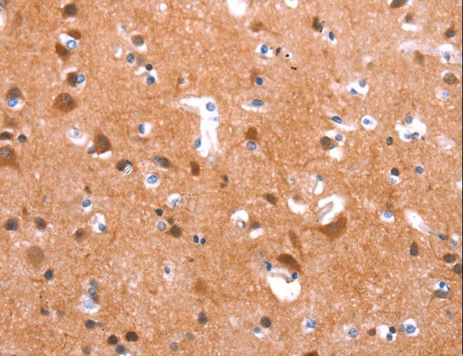 GAS8 Antibody