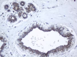 PPT1 / CLN1 Antibody (clone OTI1F10)