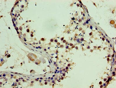 SSSCA1 / p27 Antibody