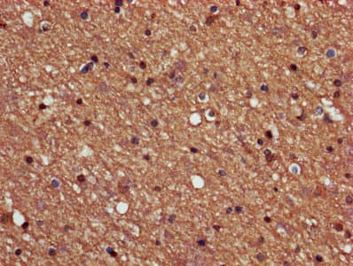 PPP2R2B Antibody