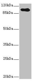 Polyclonal Rabbit anti-Human Betaglycan / TGFBR3 Antibody (IHC, WB)