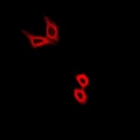Polyclonal Rabbit anti-Human HK2 / Hexokinase 2 Antibody (IF, WB)