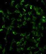 CA9 / Carbonic Anhydrase IX Antibody (aa113-143)