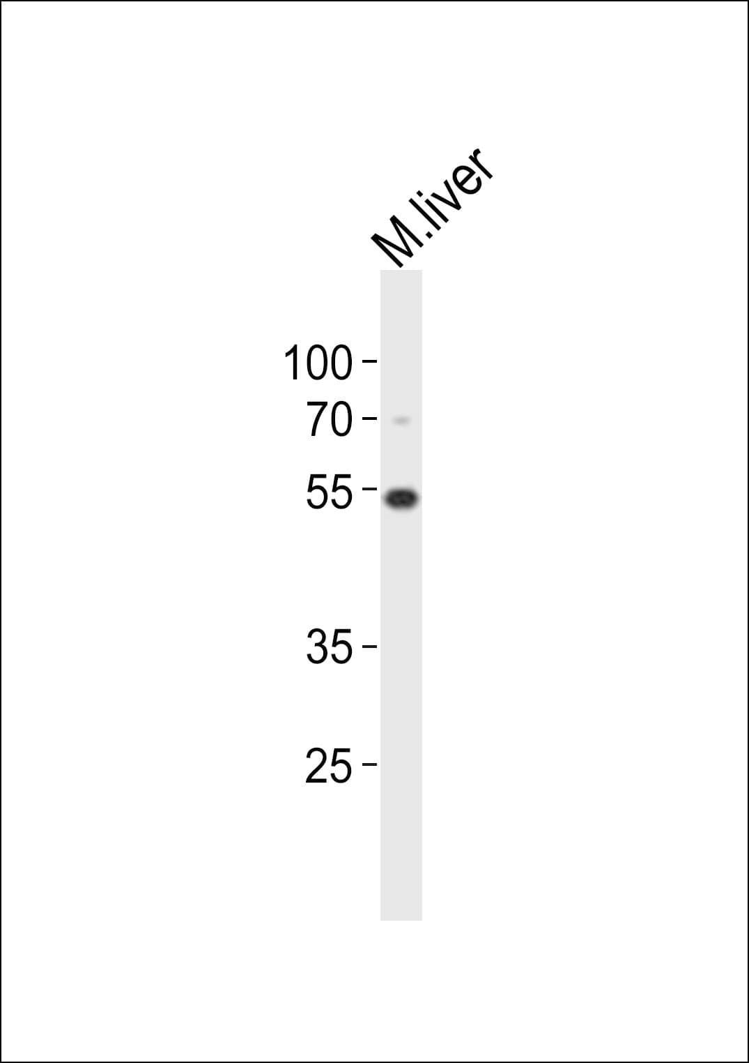 GNL3 / NS / Nucleostemin Antibody (aa450-483)