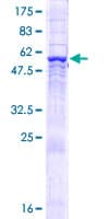 Human COPS6 / CSN6 Protein (Recombinant GST)