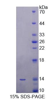 Human SRP9 Protein (Recombinant His-T7)