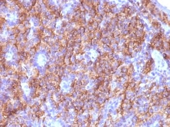 CHGA / Chromogranin A Antibody (clone CGA/413 + CHGA/777 + CHGA/798, Ready-to-Use)
