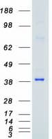 Human TRIB2 Protein (Recombinant Myc-DDK (Flag))