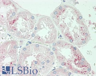 EPO / Erythropoietin Antibody
