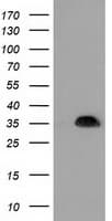 SULT1A1 / Sulfotransferase 1A1 Antibody (clone OTI2C5)