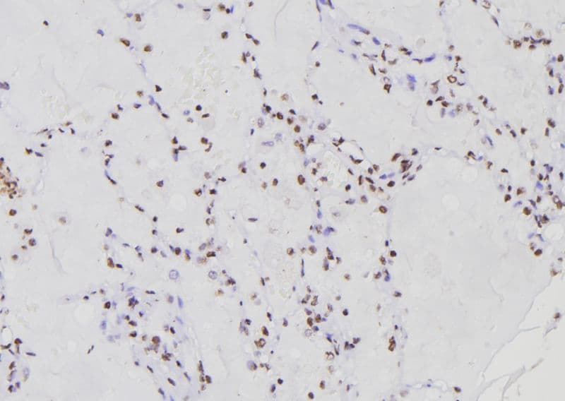 RFC1 / RFC Antibody