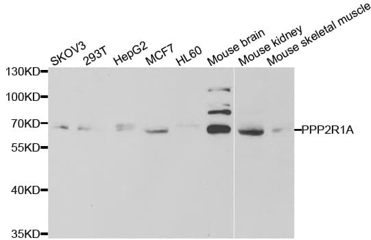 PPP2R1A Antibody
