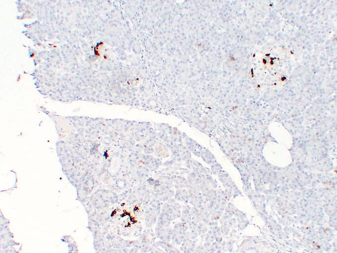 Monoclonal Mouse anti-Human SST / Somatostatin Antibody (clone ABT-SST, IHC)