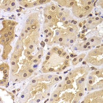PHF21B Antibody