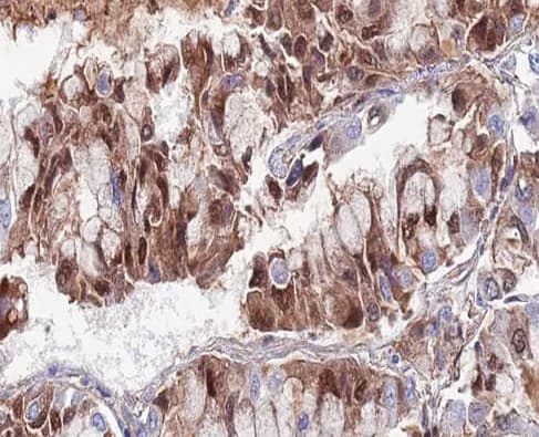 Polyclonal Rabbit anti-Human SENP5 Antibody (IHC, IF, WB)