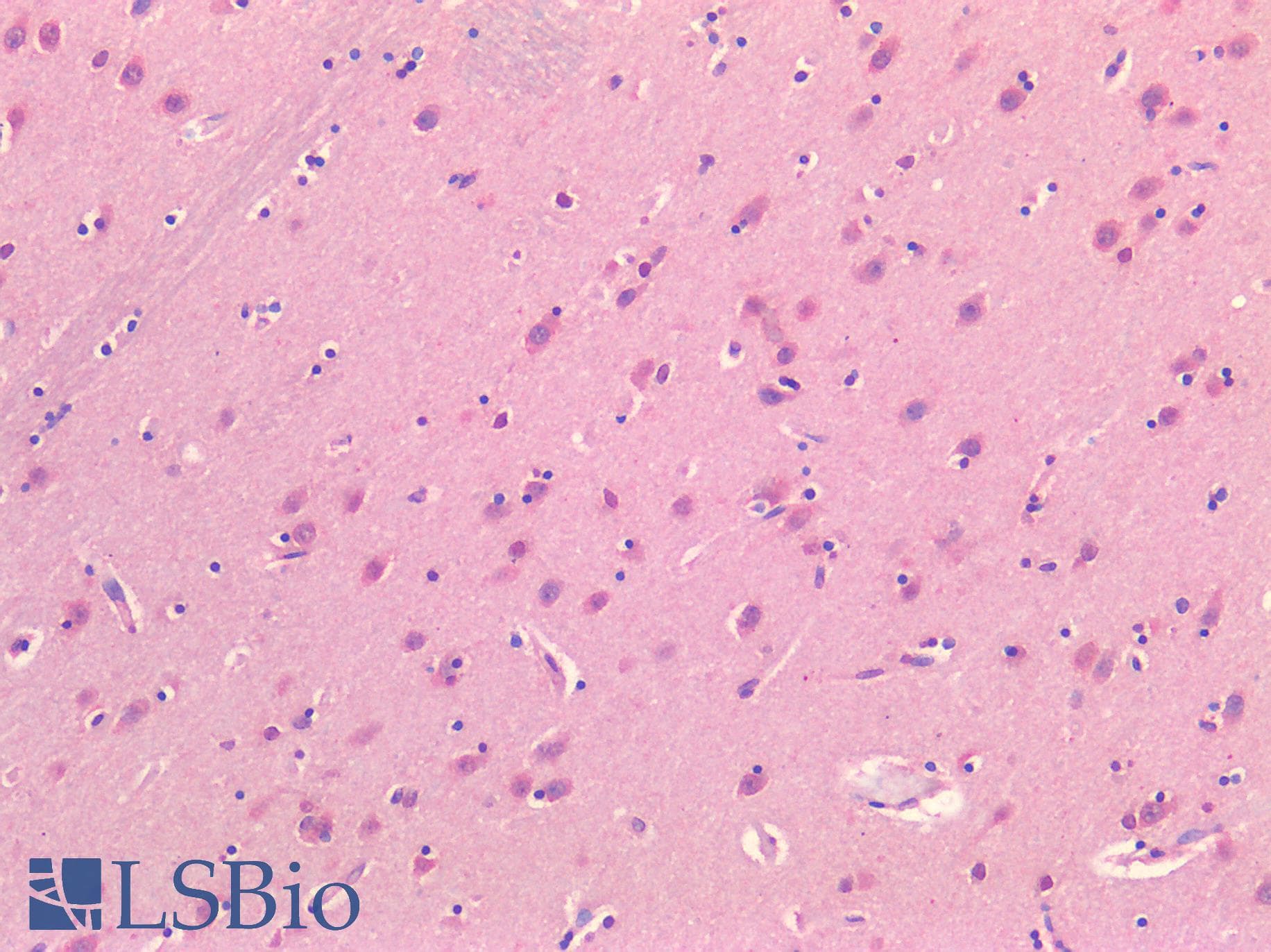 IHC-plus™ ADORA2A/Adenosine A2A Receptor Antibody