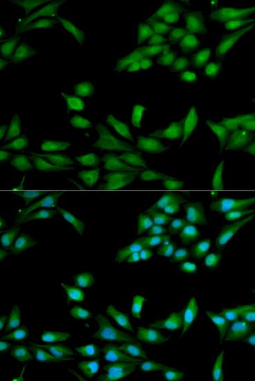 Polyclonal Rabbit anti-Human MSH2 Antibody (IHC, IF, WB)