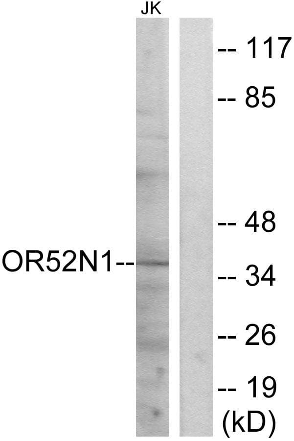 Polyclonal Rabbit anti-Human OR52N1 Antibody (IF, WB)