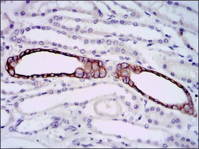 Monoclonal Mouse anti-Human BPIFA2 / SPLUNC2 Antibody (clone 1F12, IHC, WB)