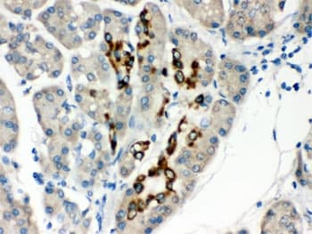 Polyclonal Rabbit anti-Human PAX6 Antibody (IHC, WB)
