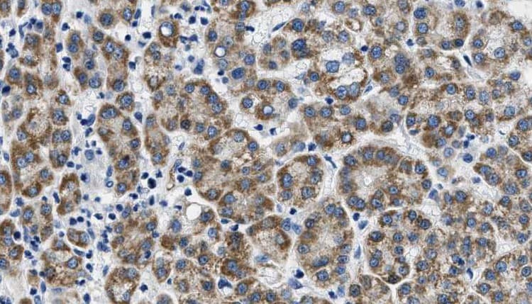 Polyclonal Rabbit anti-Human FSH Receptor / FSHR Antibody (IHC, IF, WB)
