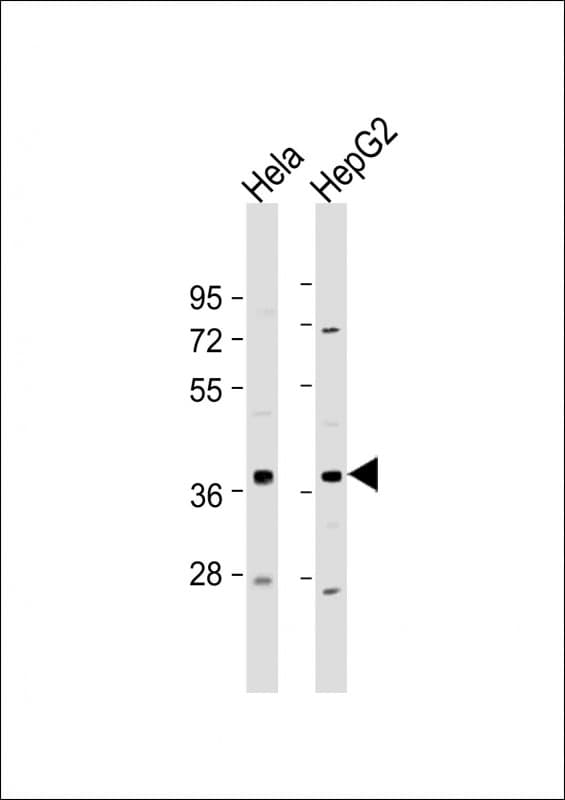 C1GALT1C1 Antibody (N-Terminus)