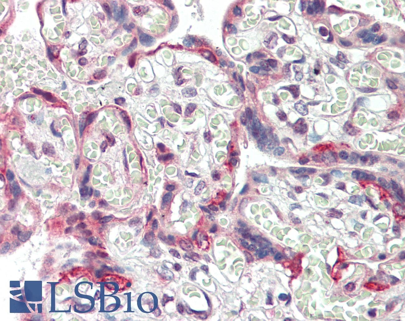 TFAP2B / AP2 Beta Antibody (N-Terminus)