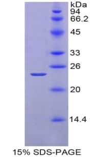 Mouse LAMA2 / Merosin Protein (Recombinant 6His, N-terminus)