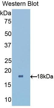 RBP1 / CRBP Antibody (aa2-135)