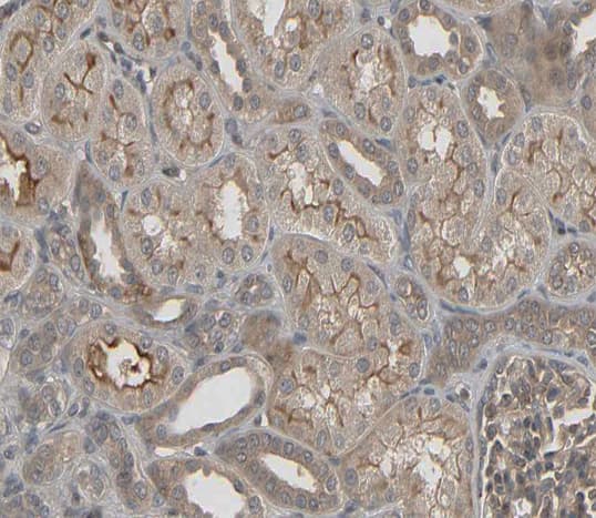 DUS2 / DUS2L Antibody