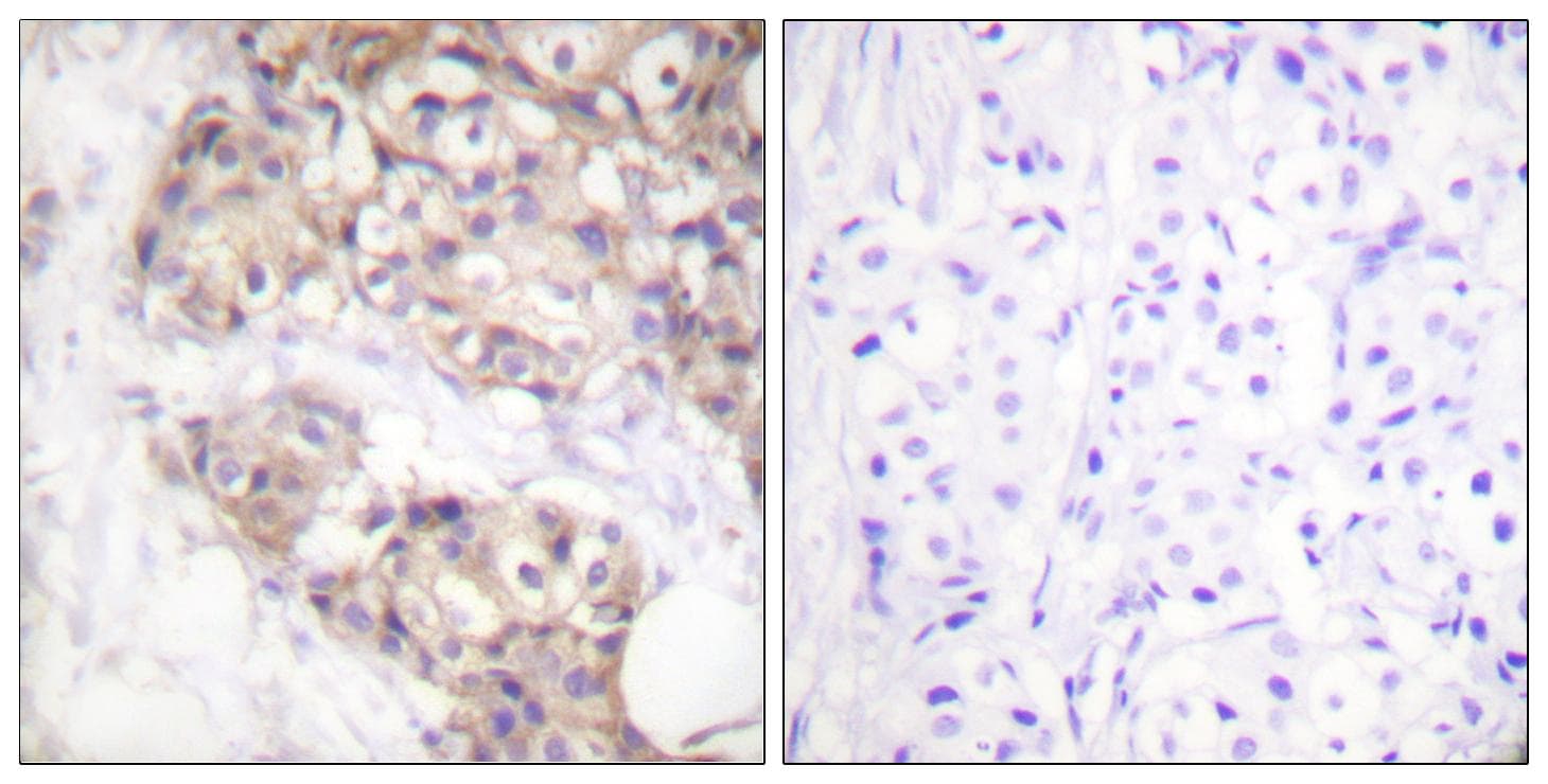 Polyclonal Rabbit anti-Human PAK2 Antibody (p20, IHC, WB)