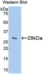 NFKBIE / IKB Epsilon Antibody (aa207-440, FITC)