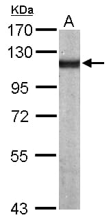 ACTN4 Antibody (aa206-542)