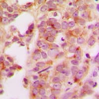 Polyclonal Rabbit anti-Human HSP70 / Heat Shock Protein 70 Antibody (Internal, IHC, WB)