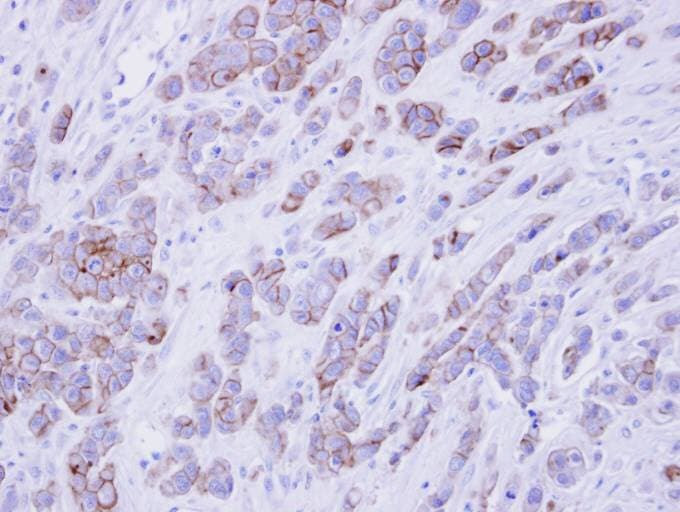 Polyclonal Rabbit anti-Human Scramblase / PLSCR1 Antibody (aa1-286, IHC, WB)