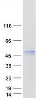 Human HFE Protein (Recombinant Myc-DDK (Flag))