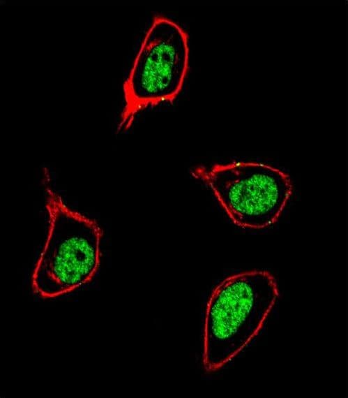 Polyclonal Rabbit anti-Human PCNA Antibody (aa231-261, IHC, IF, WB)