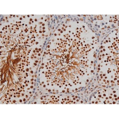 Polyclonal Rabbit anti-Human FLNA / Filamin A Antibody (phospho-Ser2152, IHC, IF, WB)