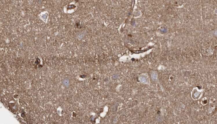 Polyclonal Rabbit anti-Human CSPP1 Antibody (IHC, WB)