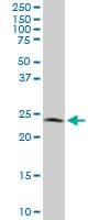 IHC-plus™ PGRMC2 Antibody (clone 3C11)