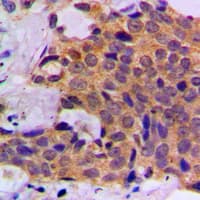CASP1 / Caspase 1 Antibody (C-Terminus)
