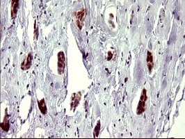 ATXN7L1 Antibody (clone OTI4F6)