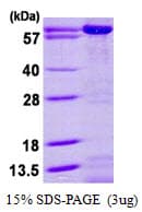 Human AK5 / Adenylate Kinase 5 Protein (Recombinant His)