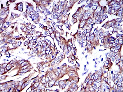 KRT19 / CK19 / Cytokeratin 19 Antibody (clone 4E8)